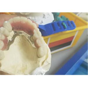 Flexible Durable Precision Attachment Denture Corrosion Resistant