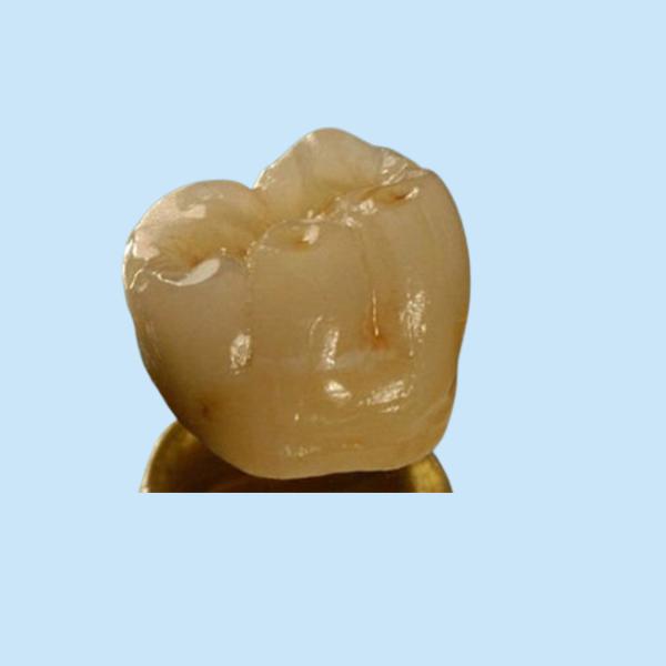 Inter Miscibility Porcelain Dental Crown