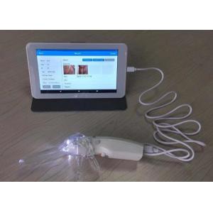 Monitor Treatment and Prevent Recurrence Digital Electronic Colposcope Self -