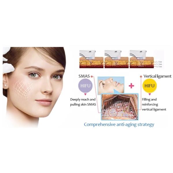 Portable HIFU Vaginal Tightening Machine , Non Surgical HIFU Facelift Machine