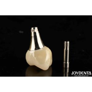 Wholesale Biocompatible Dental Implant Crown And Bridge Aesthetically Pleasing For Safe Oral from china suppliers