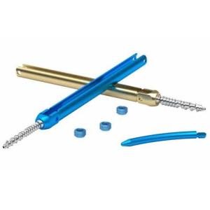 Titanium Spine Fixation System TM Minimally Invasive U Multi Axial Pedicle Screw