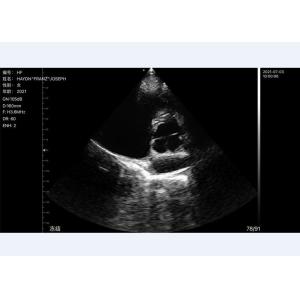 305mm Wifi Portable Ultrasound Bladder Scanner Convex+Linear+Cardiac Probe