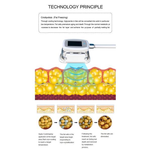 Vertical 2 Cryo Handles Work At The Same Time Cryolipolysis Weight Loss Machine