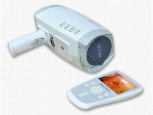 China Lens Resolution 800000 Pixels Digital Electronic Colposcope With Automatic Electronic Shutter 3.5 Inch Handheld Screen on sale