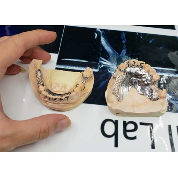 Quality High Accuracy CAD-CAM Fixed Removable Bridge Digitization Design for sale