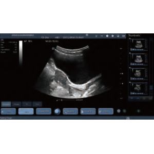 Wireless Handheld Probe Color Doppler Ultrasound Scanner With 220g Weight Only