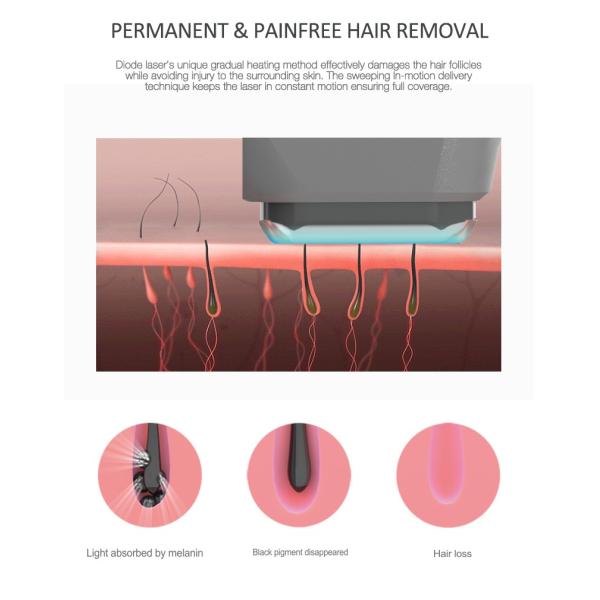 Micro Channel Diode Laser Hair Removal Machine 808nm Wavelength 13*13mm2 Spot Size