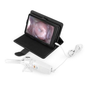 Self - Inspection Handheld Digital Electronic Colposcope Transvaginal Detector