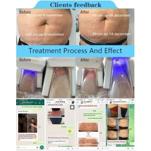 2018 Newly-released!!! The most featured Cryolipolysis Slimming Device four cryo