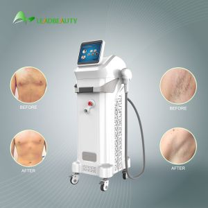 China Diode laser hair removal machine Semiconductor+Water+Air +TEC Cooling machine on sale