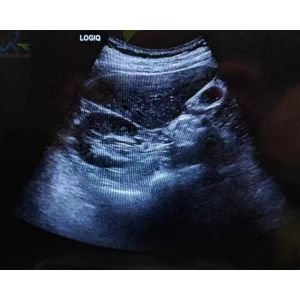 GE C1-6-D Ultrasound Probe Repair Strain Relief Lens Replacement Service