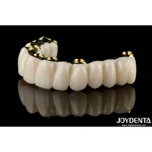 Smooth Hybrid Zirconia Implant Bridge Restoring Chewing Function Custom Made