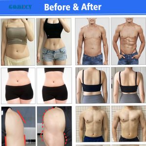 532 nm Diode Cold Laser Fat Removal Machine Fat Reduction Weight Loss Ems Body