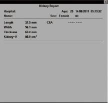 Mobile Ultrasound Machine Digital Laptop Ultrasound Scanner with 100 Frames