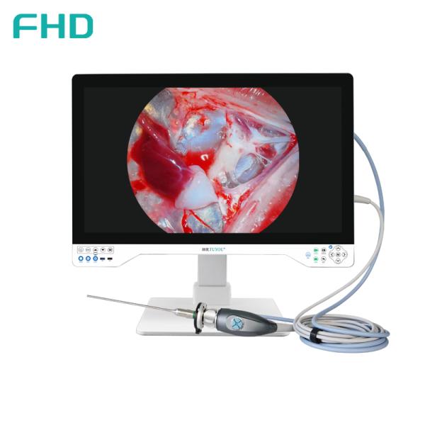 Quality TUYOU All-in-One FHD Endoscopy Camera System with 32 Inches Surgical Monitor for ENT and Urology Procedures for sale