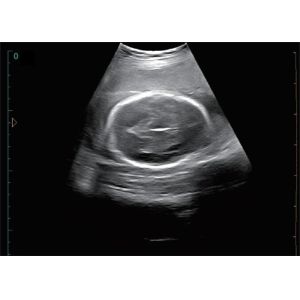 Notebook Laptop Ultrasound Scanner Bio 3000J 12 Inch Screen Portable Ultrasound