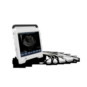 TS20 Digital Diagnostic Ultrasound System for Obstetrics and Gynecology