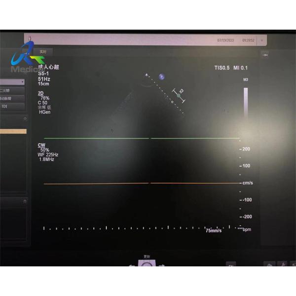 S5-1 Linear Array Ultrasound Transducer Probe Crystal Array Replacement