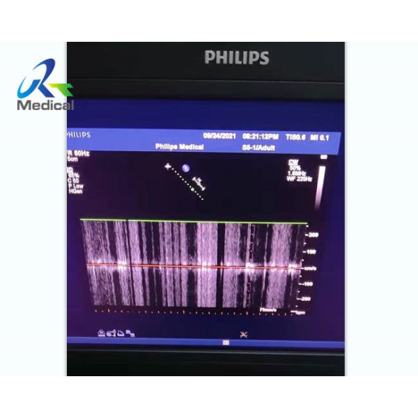 Quality  IE ELITE Ultrasound Machine Repair Clutter Interference Cw Function for sale