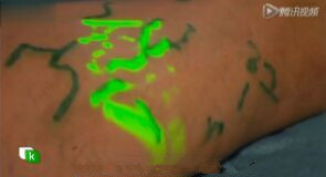 High Contrast Image Vein Light Vein Locator Device For Medical Puncture by