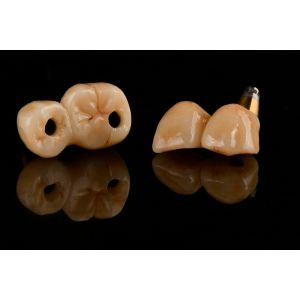 Self Tapping 3.0mm Thread Dental Titanium Implant Optimized Functionality