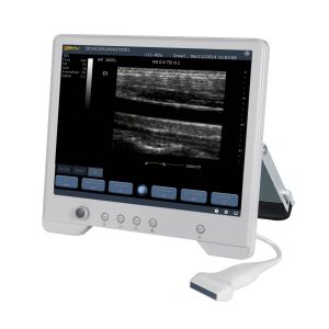 TS20 Digital Diagnostic Ultrasound System for Obstetrics and Gynecology