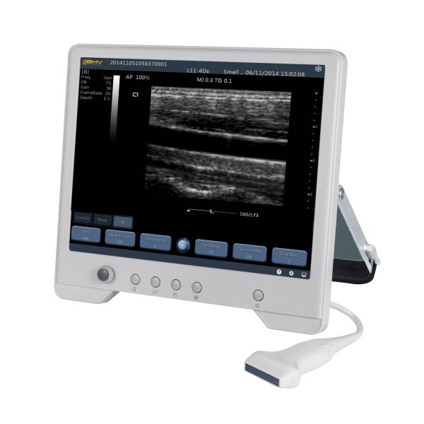 TS20 Digital Diagnostic Ultrasound System for Obstetrics and Gynecology