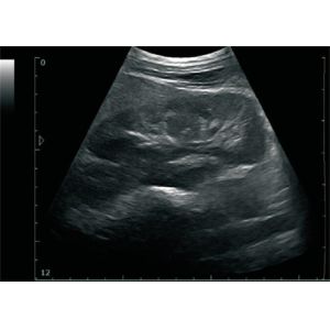 Ultrasonic Device Digital Mini Laptop Ultrasound Scanner BIO 3000J with 12 Inch