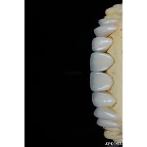 Glossy Surface Texture Feldspathic Veneer Natural Looking Porcelain Veneer
