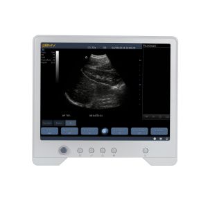 TS20 Digital Diagnostic Ultrasound System for Obstetrics and Gynecology