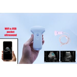 Visual Convex Array Usb Wifi Ultrasound Probe