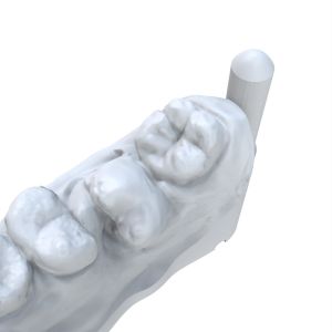 Gray Biocompatible 3d Printing Resin Dentures Biocompatible Uv Resin