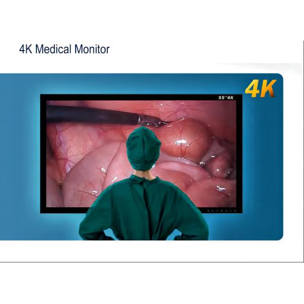 Quality 4K Endoscope Camera One Touch for Easy Video Recording and Quick Access to Important Information for sale