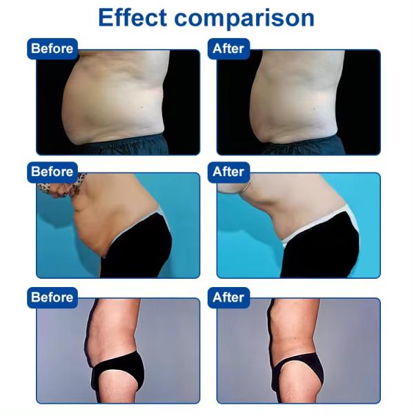 Contactless Body Area Fat Reduction Body Sculpting Slimming Equipment For Home Use And Beauty Salon