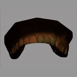 Biocompatible Full Ceramic PFZ Bridge With CAD / CAM System