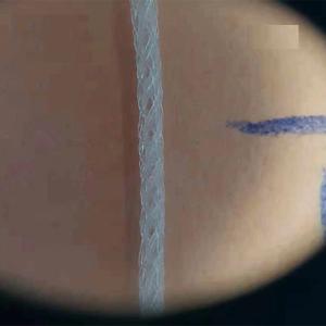 Cog Mono PDO Threads Lifting 4D 27g 38mm 90mm Mesh For Face Body Lifting