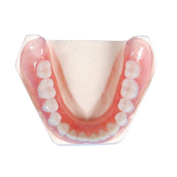Comfortable Porcelain Crowns Healthy Teeth Realistic Looking Ceramics