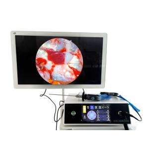 Full HD 1080P ENT Portable Endoscopy Camera With Touchscreen And LED Light