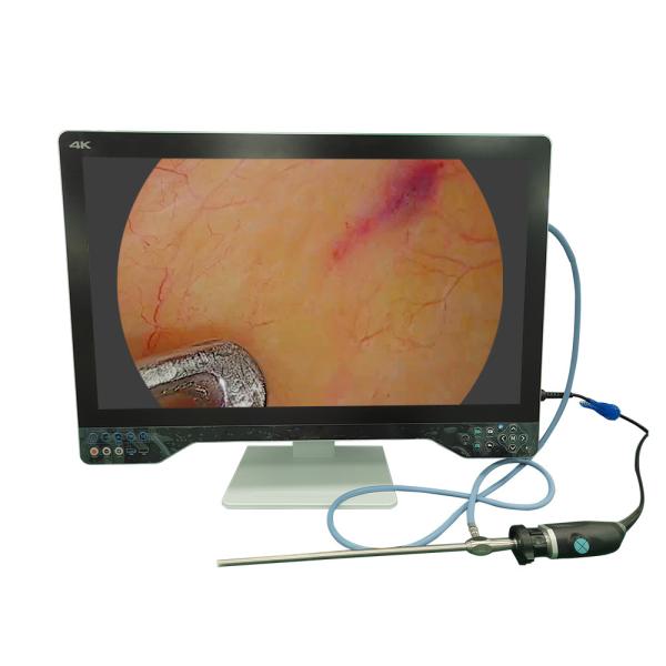 Quality TUYOU 32" 4K Medical ENT Endoscope Camera System Complete with USB Laparoscopic Function, Light Source & Monitor for sale