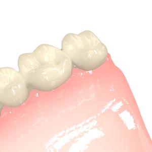 Denture Fabrication Light Cured Resin Lightweight Biocompatible Resin