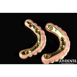 Natural-looking Aesthetics Zirconia Hybrid Bridge With High Durability And