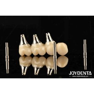 Ultra-precision processing Zirconia Implants All-Zirconium Integrated Crown