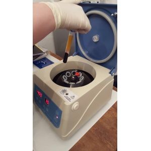 PRP/PRF CENTRIFUGE Equipment Kit PRP platelet rich plasma Medical Laboratory