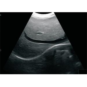 Notebook Laptop Ultrasound Scanner Bio 3000J 12 Inch Screen Portable Ultrasound