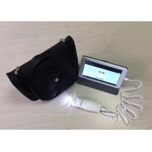 Digital Endoscope Self-Inspect Colposcope Mini Colposcopy with Range of