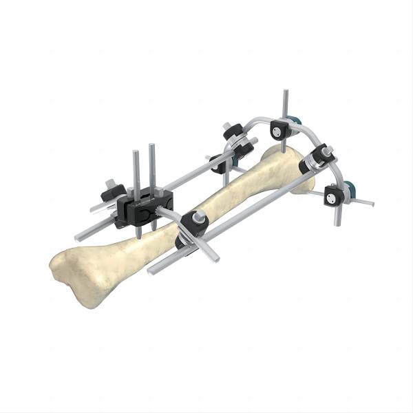 Quality Humerus Tibia Monolateral External Fixator Q Type Combined External Fixation Device for sale