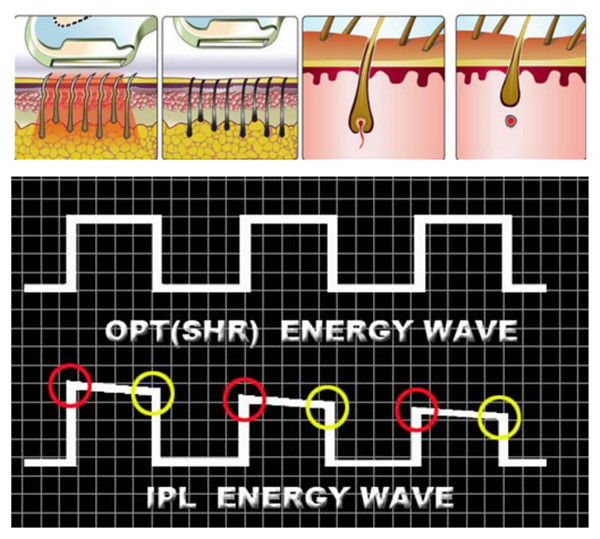 Skin Rejuvenation E Light Laser IPL Machine Equipment 2 In 1 Acne Treatment