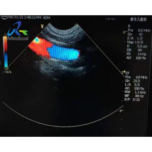 GE 8C-RS Micro Convex Ultrasound Transducer Probe Cable And Crystal Array