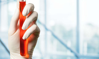 Hematology Analyzer Reagent for DIRUI BF-6700 BF-6600 Diluent Lyse Dye with barcode